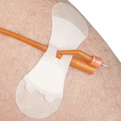 Grip-Lok Catheter Securement