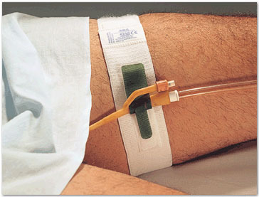 Catheter Thigh Strap