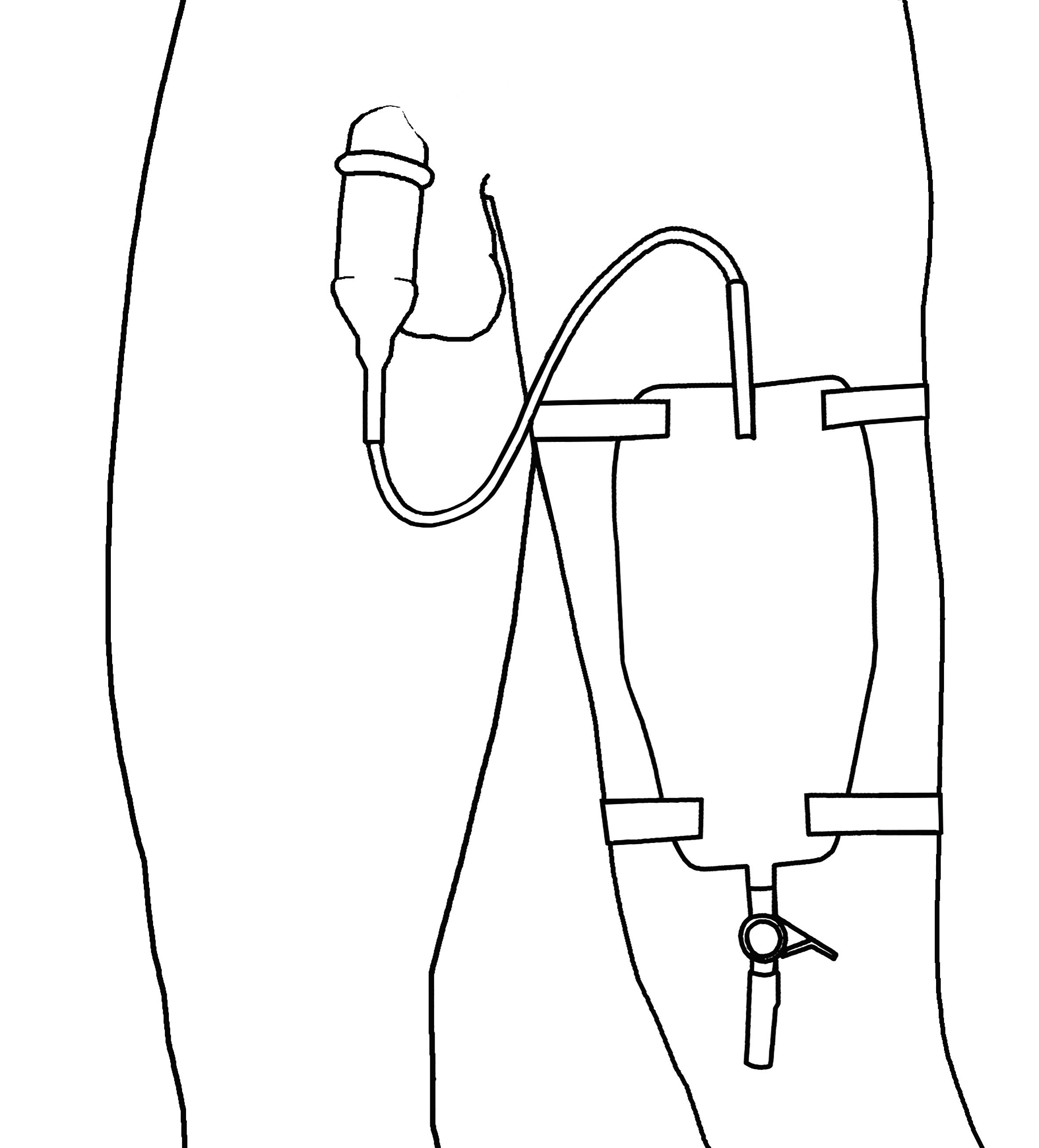 Male External Catheter System