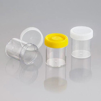 Sterile Specimen Jar