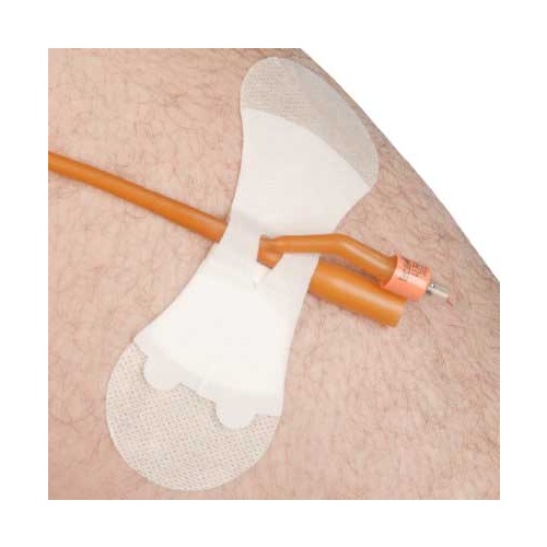Grip-Lok Catheter Securement